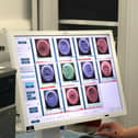 Galway Fertility Clinic's Laboratory Director Jenny Cloherty operates one of the Clinic's two embryoscopes