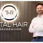 Mike Malone, Managing Director and Founder at Total Hair Restoration Galway and Dublin  