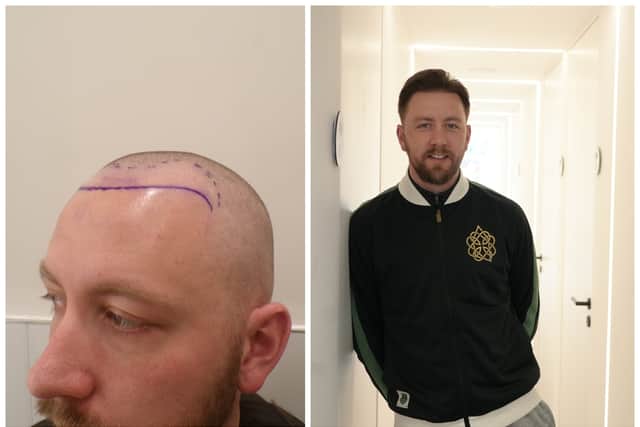 Paul's hair before and after