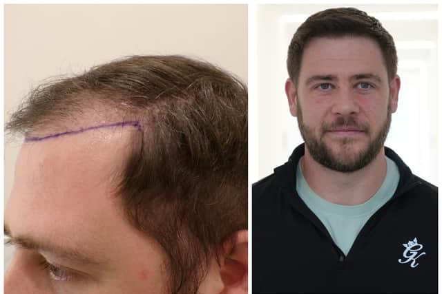 Cian's hair before and after