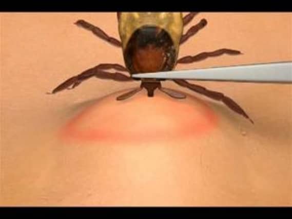 How to remove a tick- as advised by national support group Tick Talk Ireland