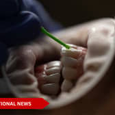 Illegal products could cause serious side effects including chemical burns, gum irritation, pain and tooth sensitivity