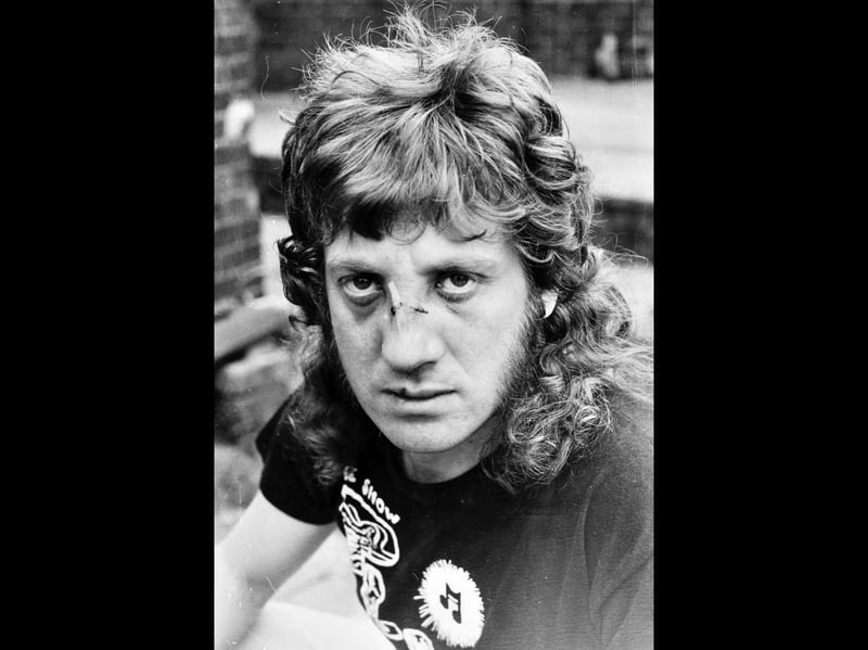 This is what happened to Noddy when the group played the Stoneleigh Club in Porthcawl in South Wales in August 1978. He said: "The kids at the Stoneleigh were getting up and dancing and enjoying themselves when bouncers started coming on stage. I told them to get off and one of the bouncers became particularly aggressive towards me and said 'I'll get you later.' At the end of the show - we had been on stage about one and three quarter hours - I was making my way to the dressing room when this bloke smashed me in the face and broke my nose."