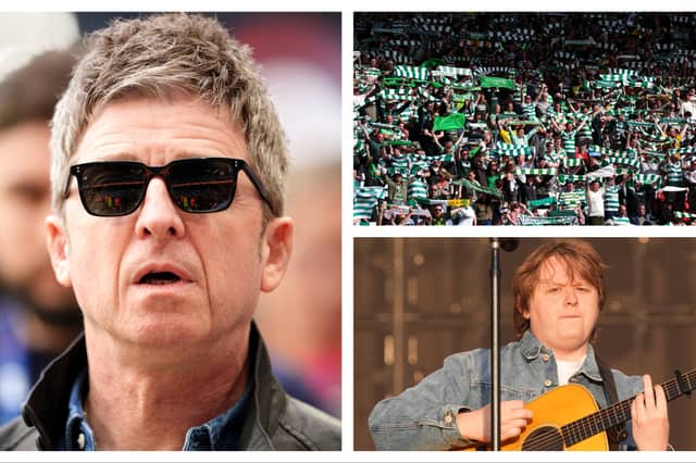 Take a look through our gallery to see 33 famous celtic fans.